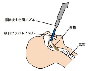 吸引フラットノズル使用方法