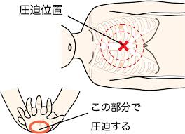 心臓マッサージ